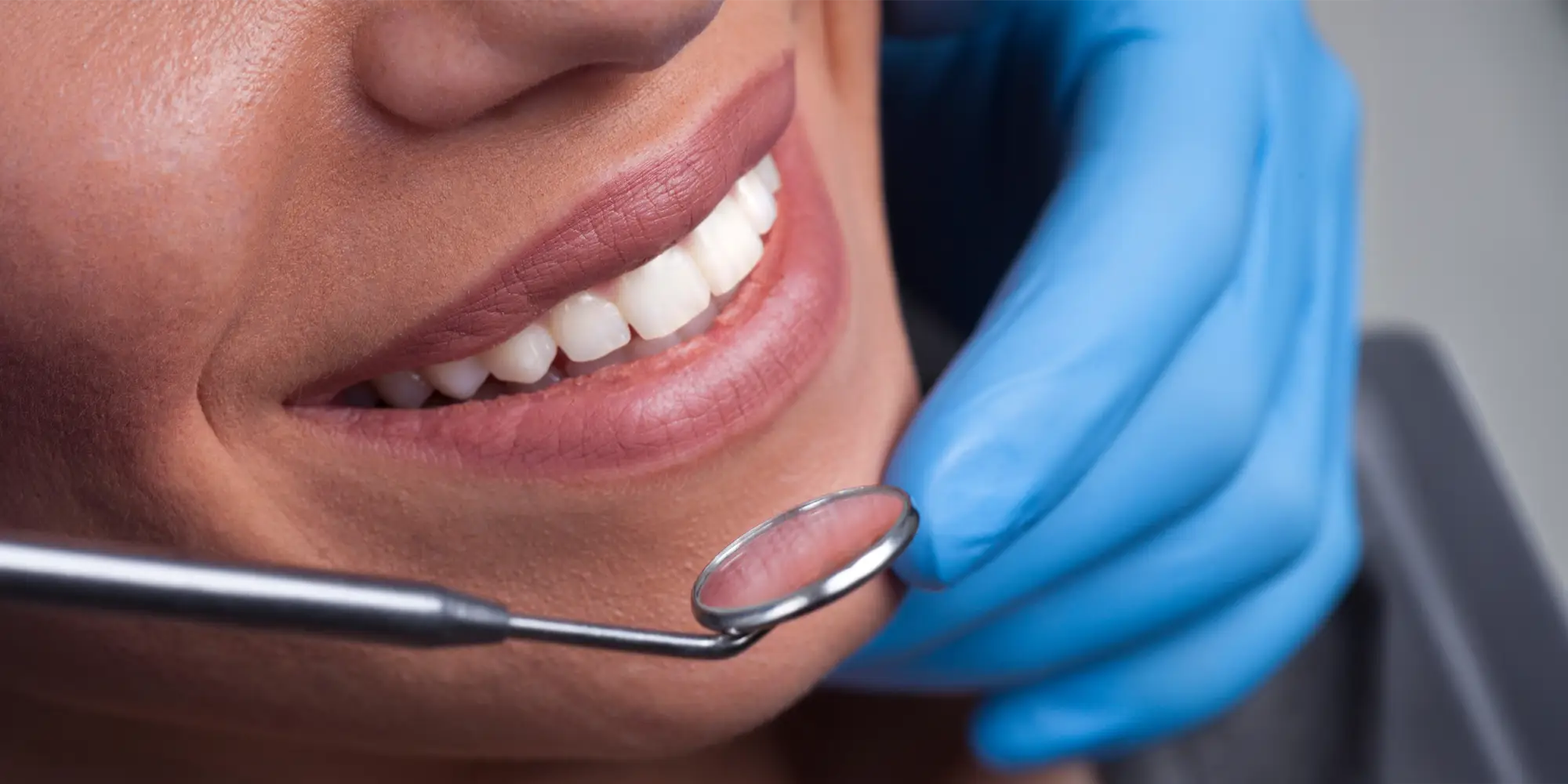 Dental San Mateo CA Smiling Woman